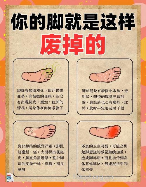 光脚走卵石路治糖尿病足？这3个误区需警惕