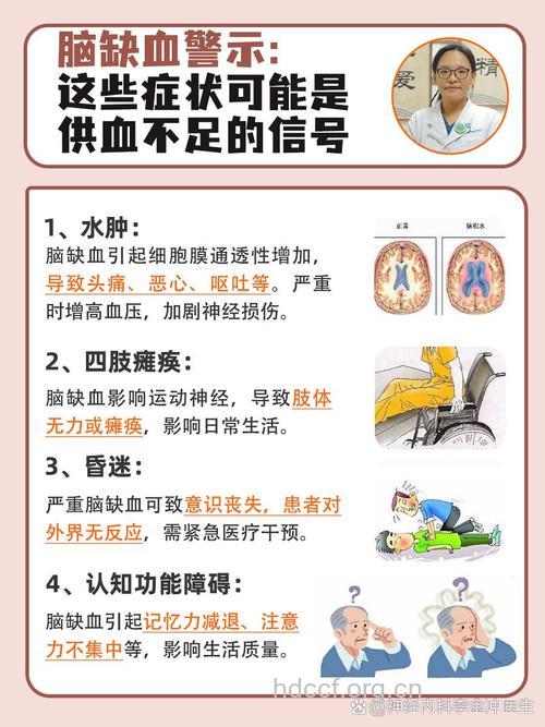 关于缺血性脑血管疾病有哪些常识