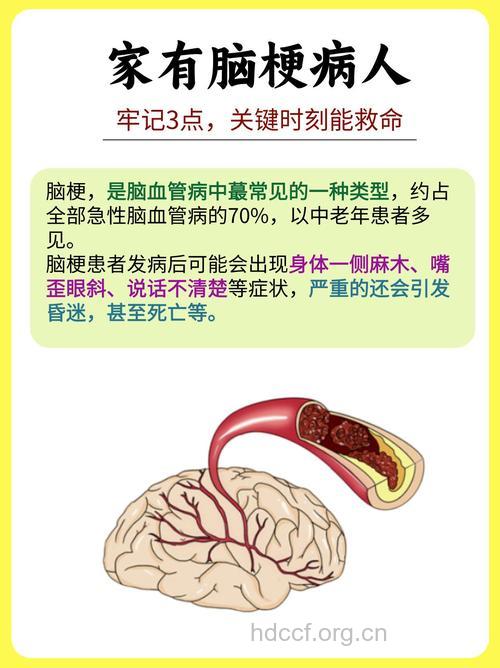 关于脑血栓有哪些常见问题
