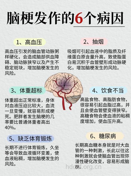 哪些原因导致脑梗死年轻化