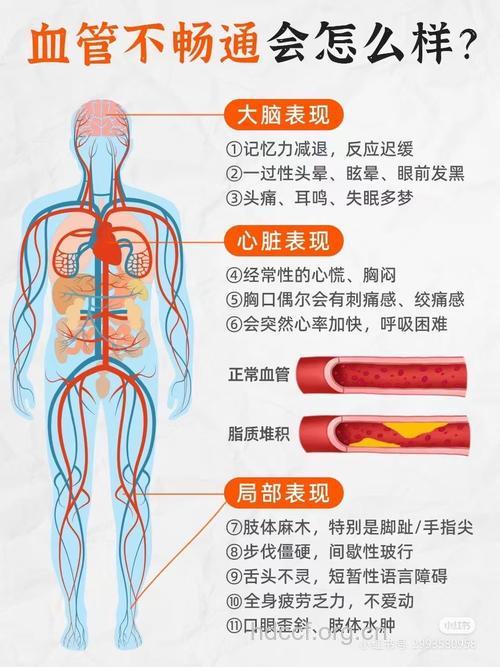 脑血管疾病的表现有哪些?