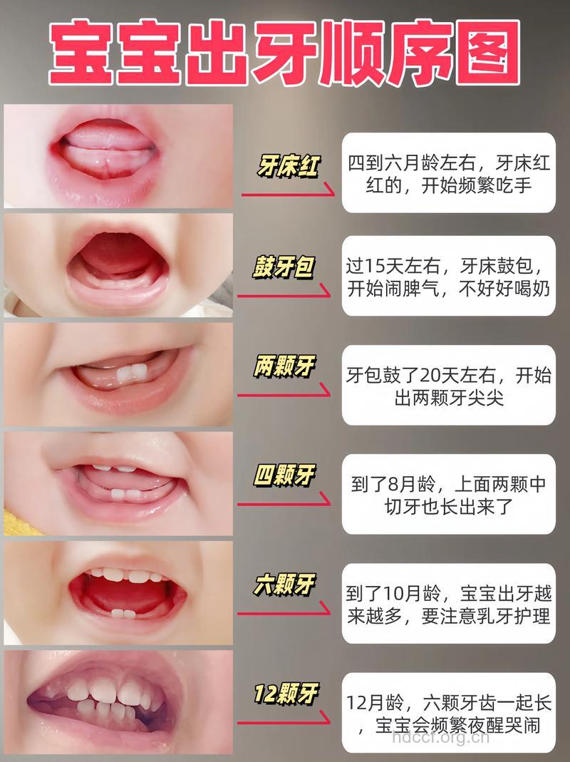 从出生开始护牙