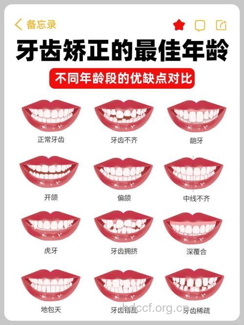 牙齿矫正的最佳时机