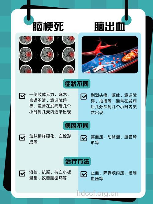 脑卒中是脑梗死还是脑出血?