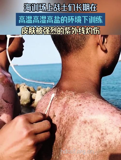 紫外线强烈 皮肤你伤不起