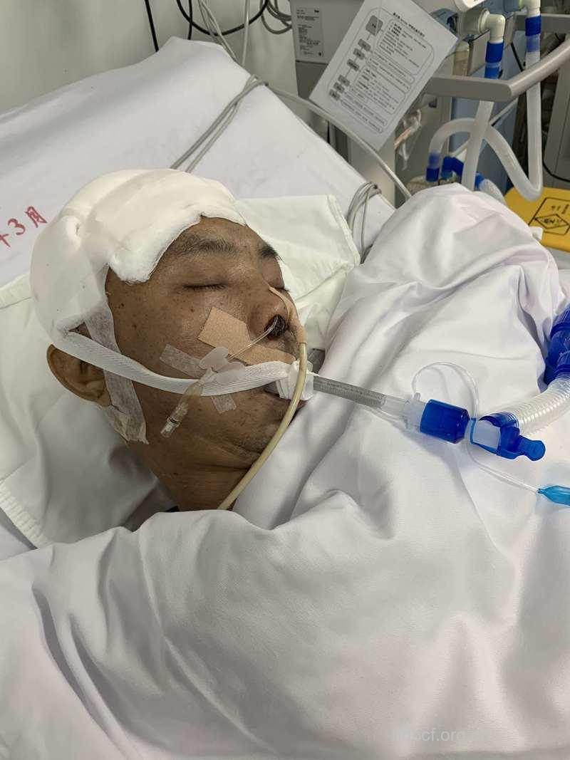 冷敷头部—抢救脑出血