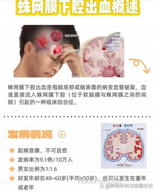脑动脉瘤破裂出血与高血压脑出血的鉴别