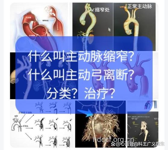 中医眼中的主动脉弓综合征