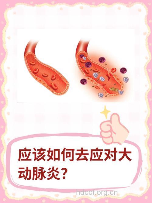 如何治疗巨细胞动脉炎？
