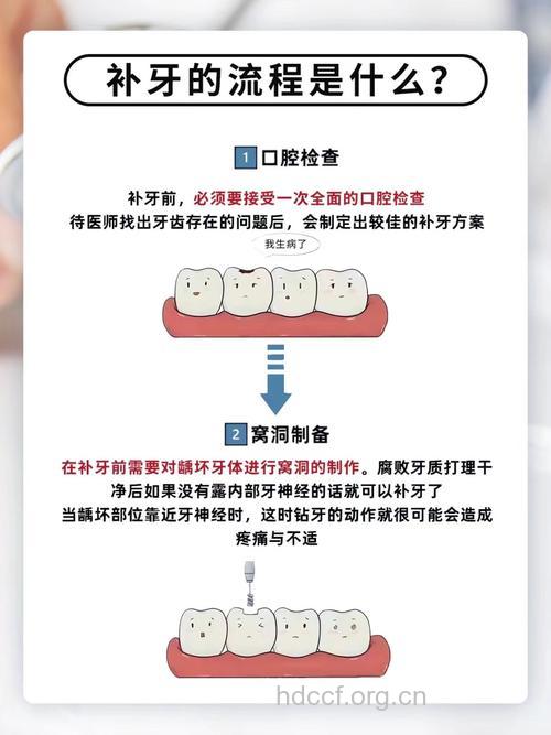 补牙后必须要注意的5个问题