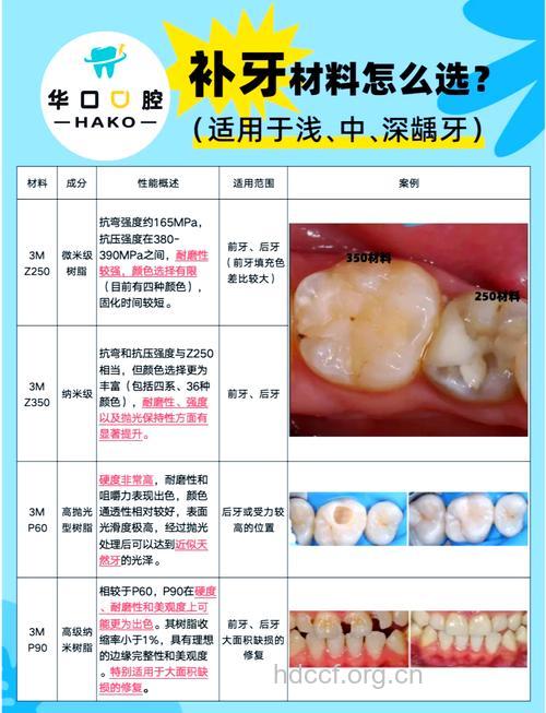 补牙材料脱落的四大原因