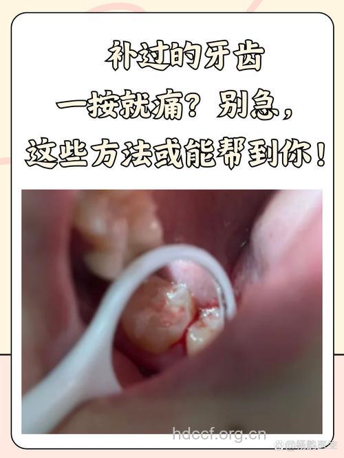 补牙会不会疼