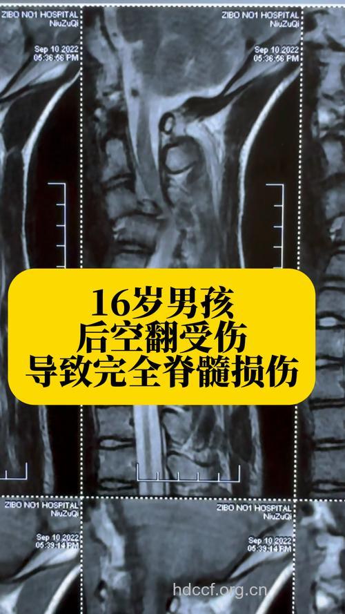 小儿脊髓损伤的症状有哪些