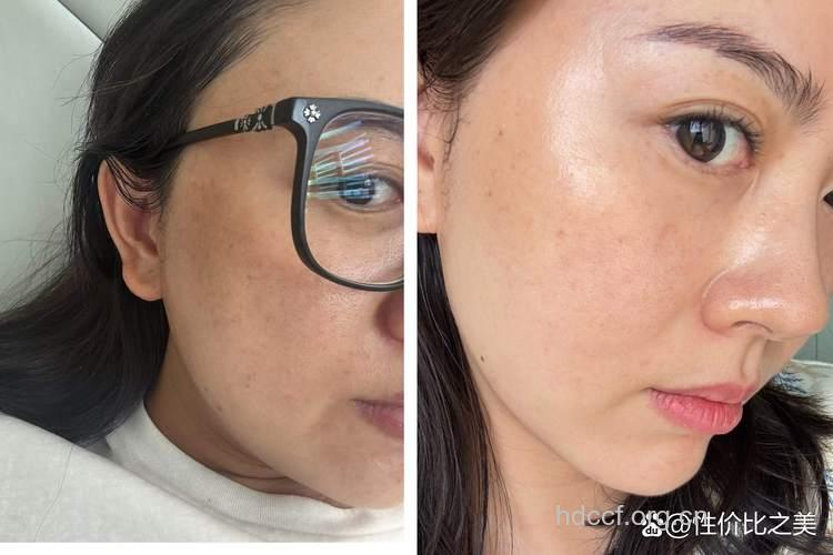 春日速甩掉肌肤斑点和暗沉