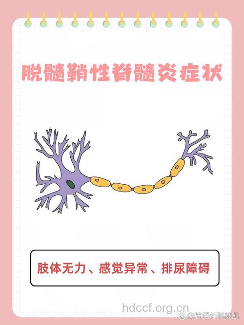 脱髓鞘性脊髓炎的诊断及治疗
