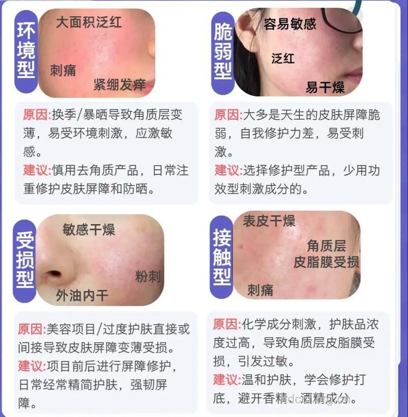 解读药妆品牌逃离敏感肌肤