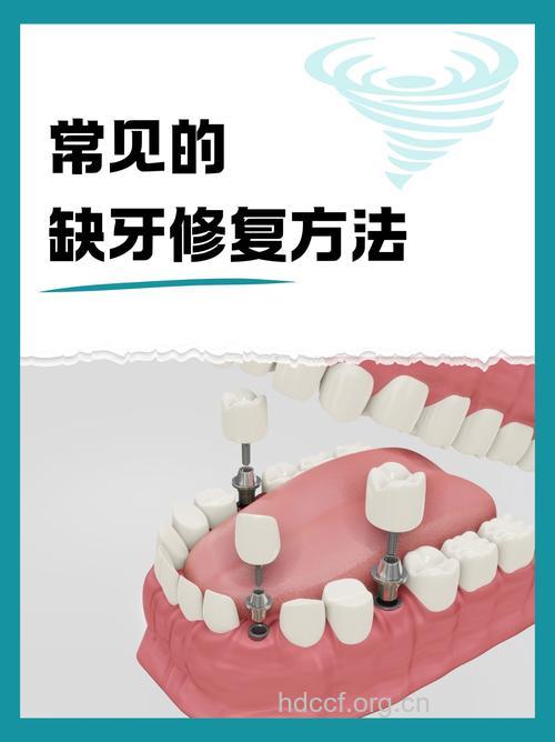临修复牙体缺损有新技术