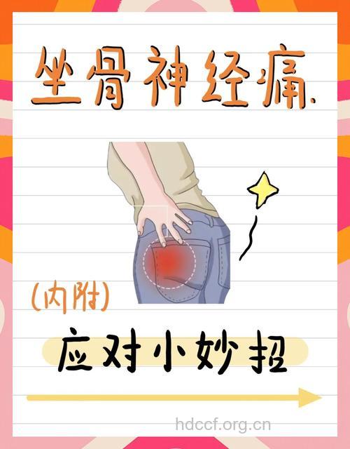 如何自我判断坐骨神经痛