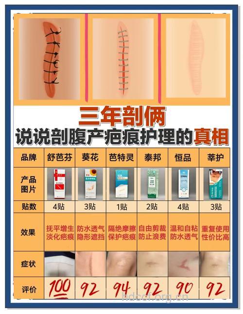 怎么判断剖腹产伤口愈合情况