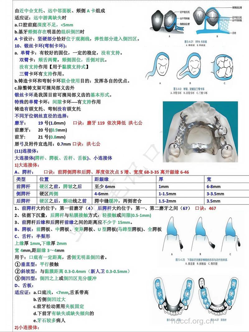 可摘局部义齿的七条军规