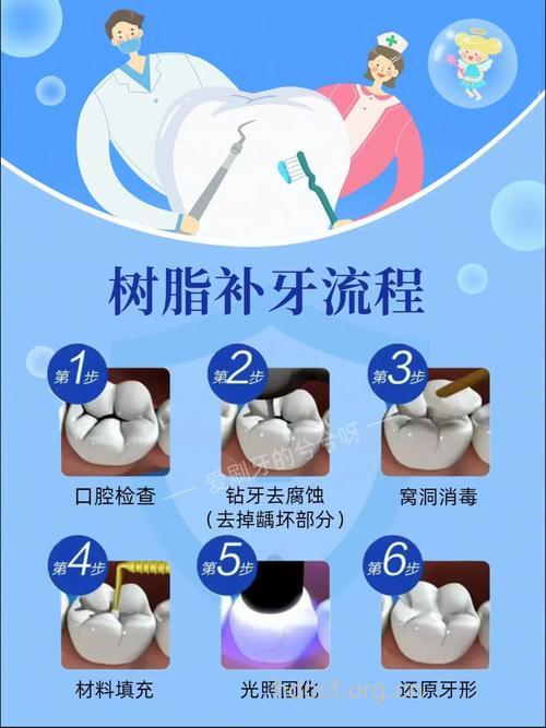 关于补牙有哪些步骤