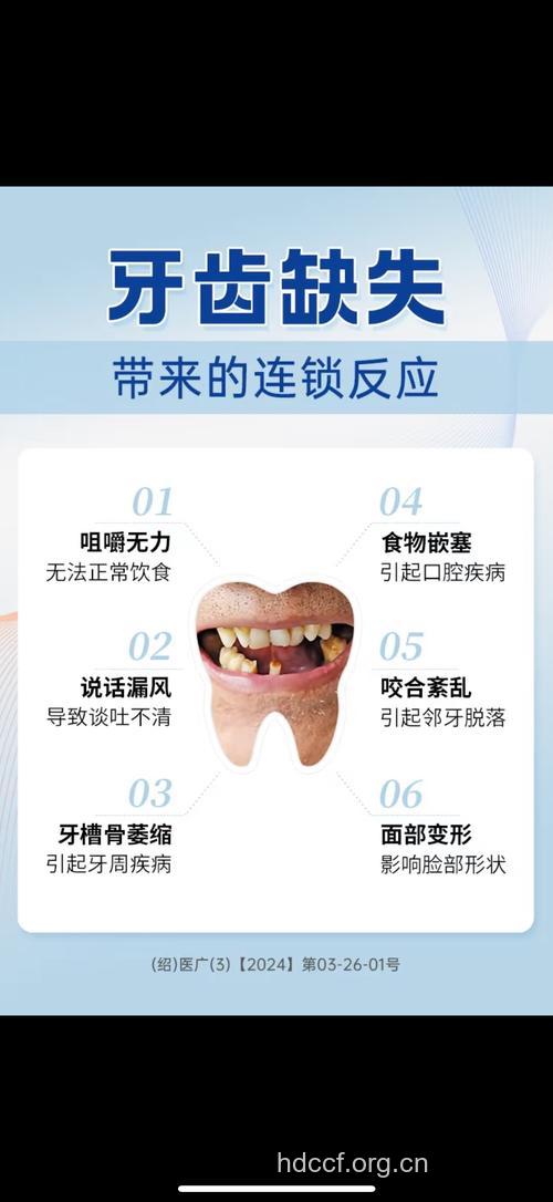 哪些口腔疾病导致掉牙