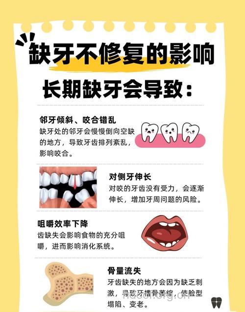 牙缺失不及时补有哪些危害