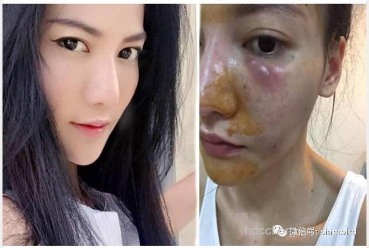 小心毁容 注意五大初春美白误区