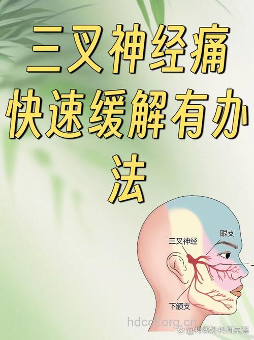 三叉神经痛的自我按摩法