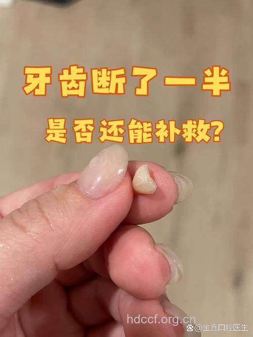 碰断的牙齿也能够接上吗？