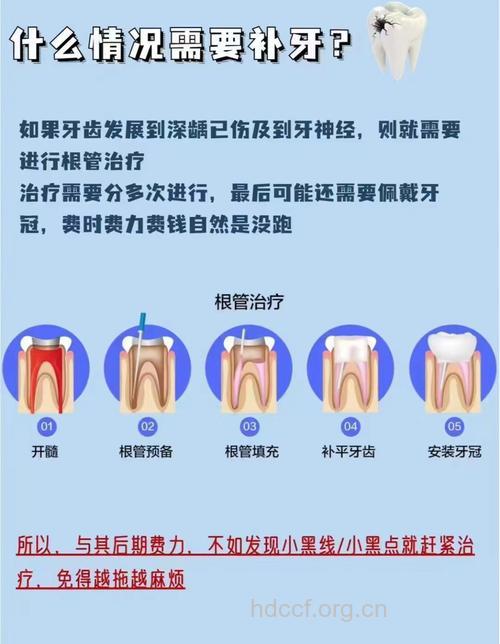 解读:补牙为何越早越好?