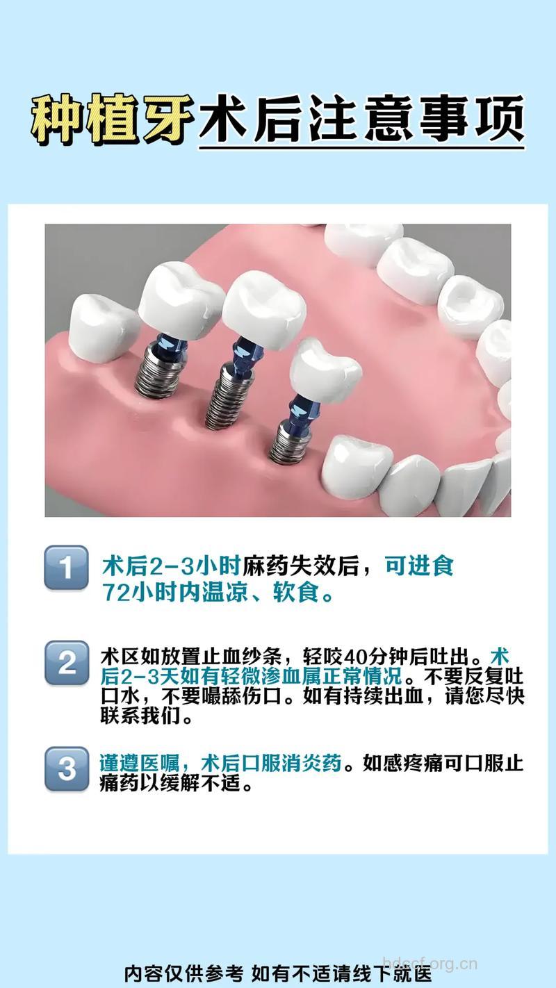 出现这2种情况要做种植牙