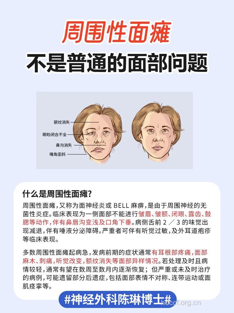 哪些原因导致周围性面瘫