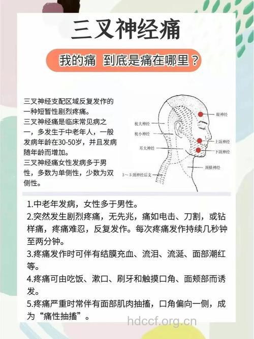 三叉神经痛的4个常识问题