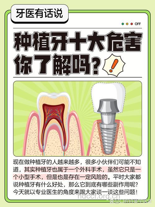 种植牙可能会出现的10个危害