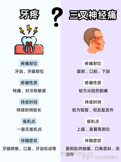 如何鉴别三叉神经痛?