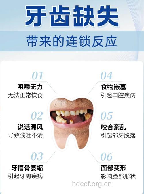 种植牙效果受三大因素影响