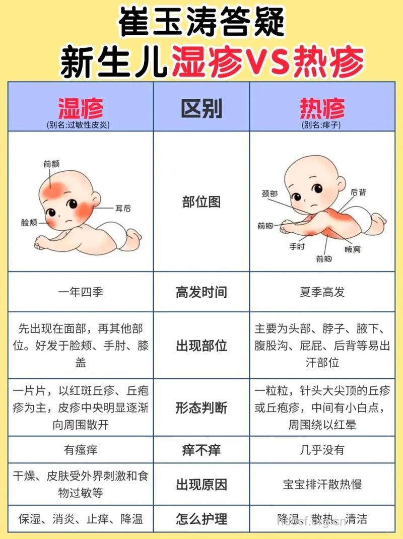 如何辨别婴儿是否有患湿疹
