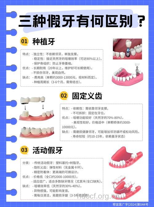 种植牙与传统假牙相比的三大优点