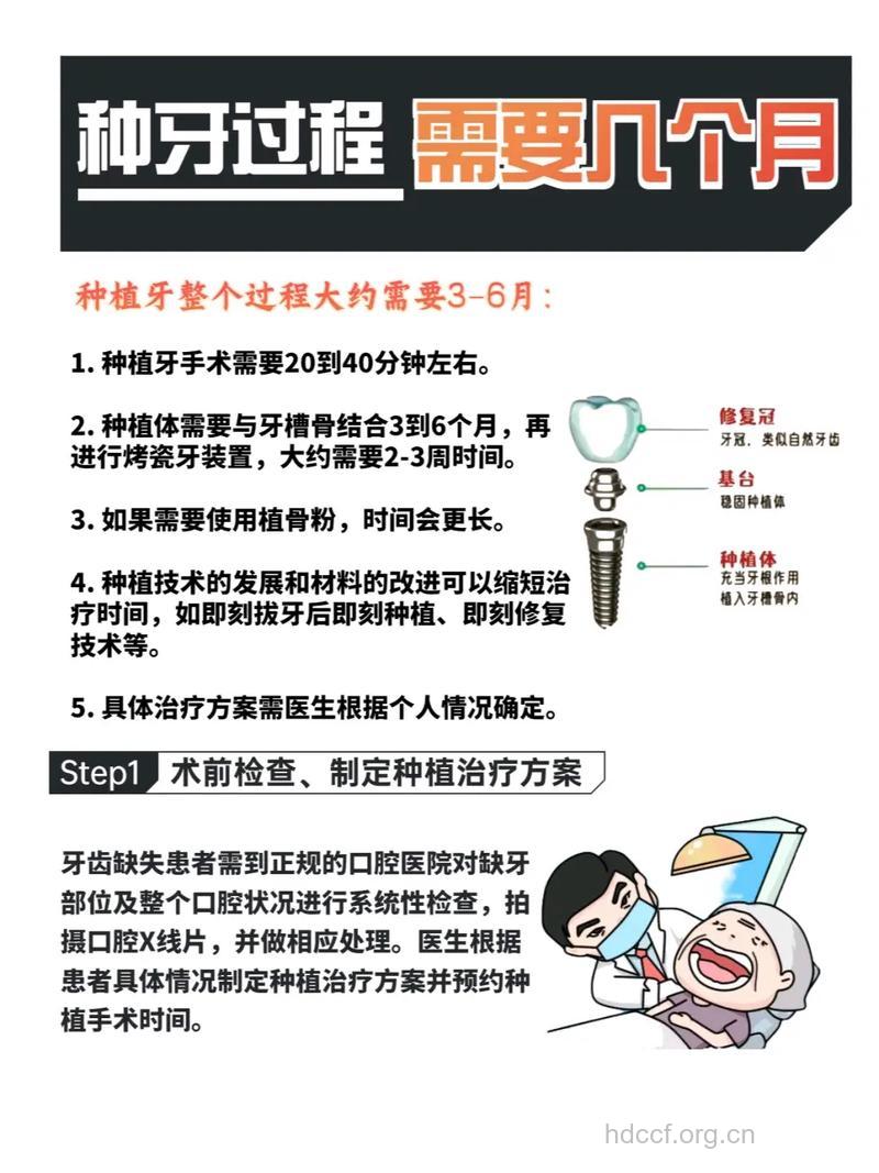种植牙能“活”多久