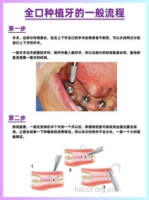 在什么情况下可以做种植牙