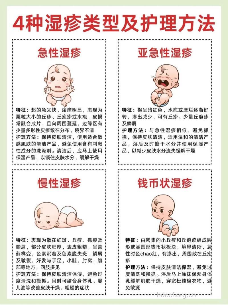 推荐四种人气婴儿湿疹偏方