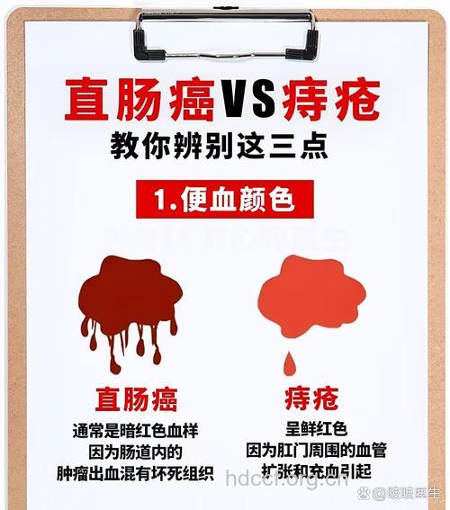大便出血怎么回事 可能是直肠癌发作