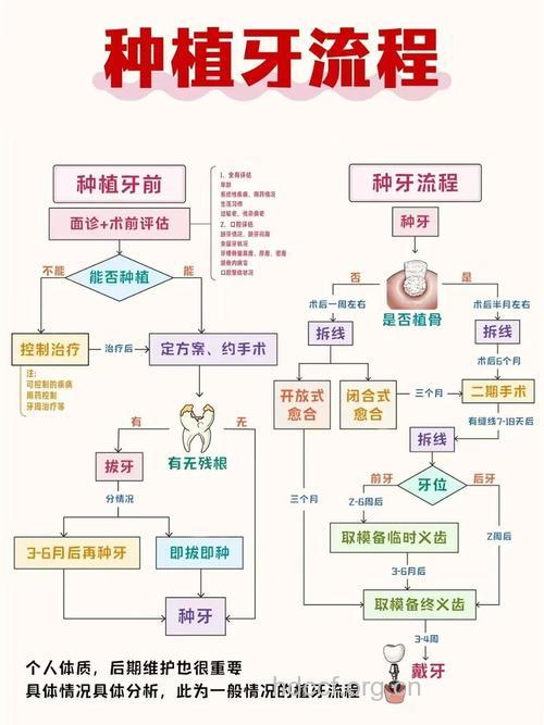 教你了解种植牙方法