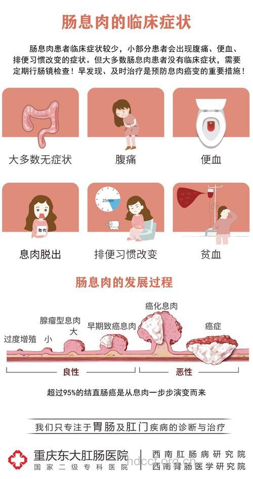 大肠息肉是什么 症状有哪些