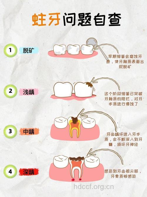 牙齿早期怎么进行全面检查方法