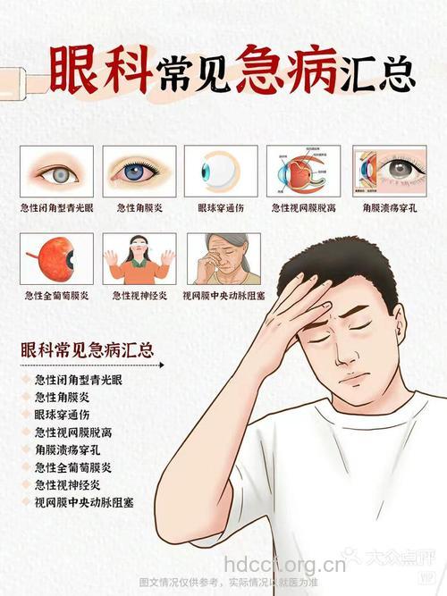 电脑男易得哪些眼科疾病