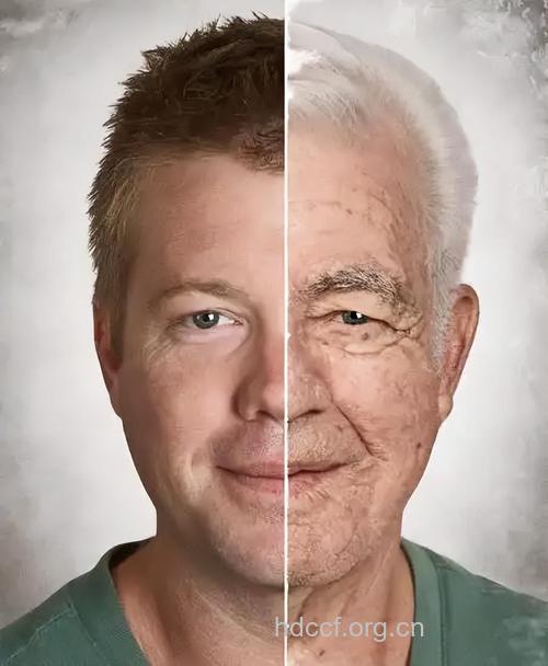 男性有哪些衰老特征