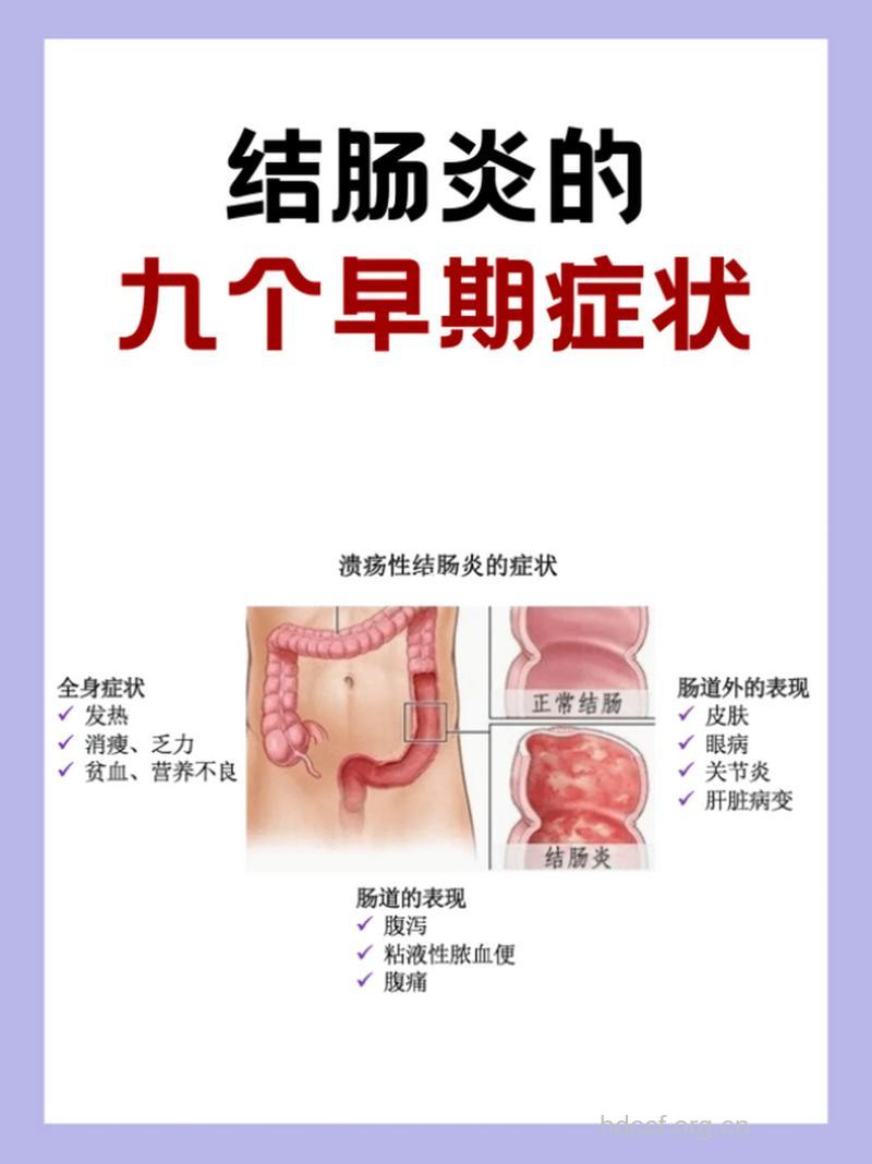 结肠炎的早期症状有哪些