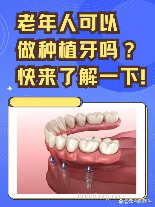 老年人适合做人工种牙吗？